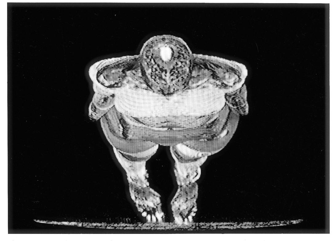 An MRI view of a person viewed from above; the shape of their body, depicted in white on black, is distorted.