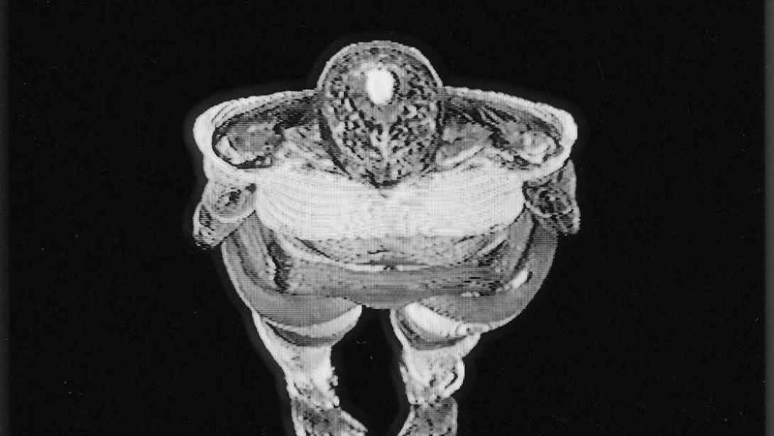 An MRI view of a body, viewed in a 'slice' from above.